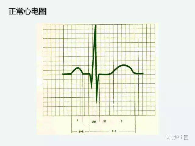 cb9b8408b01b4438a1402920affeb7b1.jpeg