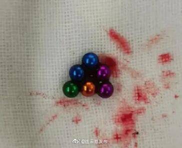 玩具|两个月15名孩子因为这种玩具命悬一线