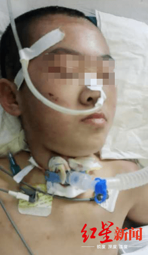 恒耀平台注册山西怀仁12岁女童疑遭继母虐待致脑梗死,检方提前介入 (图2) 恒耀平台注册山西怀仁12岁女童疑遭继母虐待致脑梗死,检方提前介入 (图2)