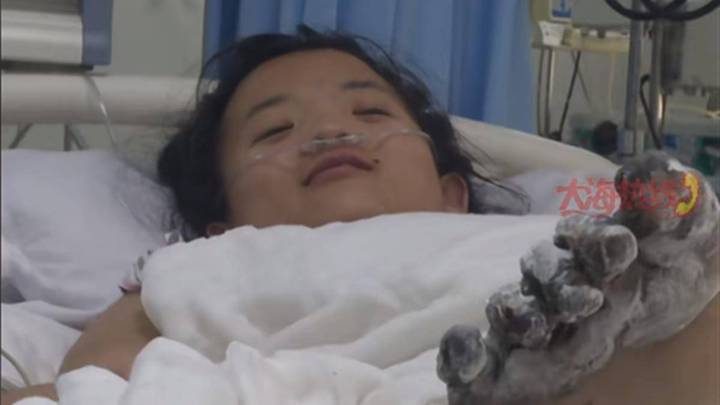 女孩充电时玩手机被电击需截肢,能找苹果索赔吗?