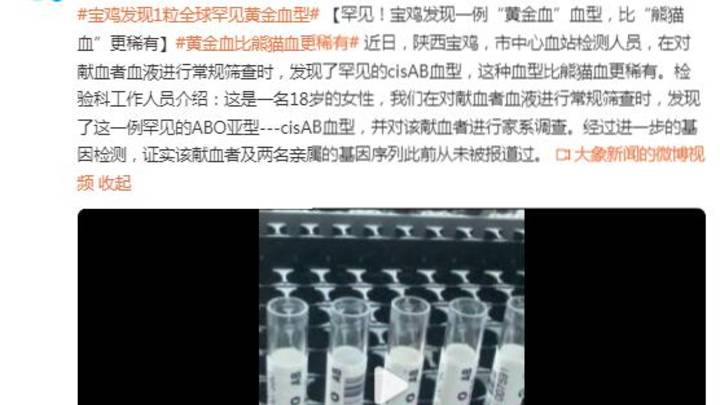 宝鸡发现一例稀有黄金血血型,你听说过黄金血吗?