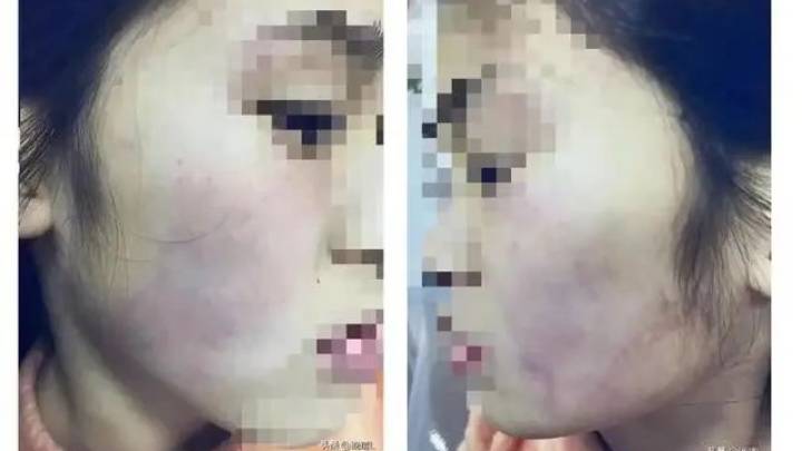 小学教师连扇女生数十耳光,是故意的吗?
