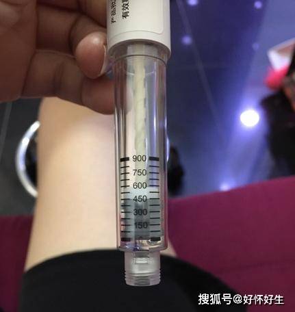 什么是试管婴儿微刺激方案?