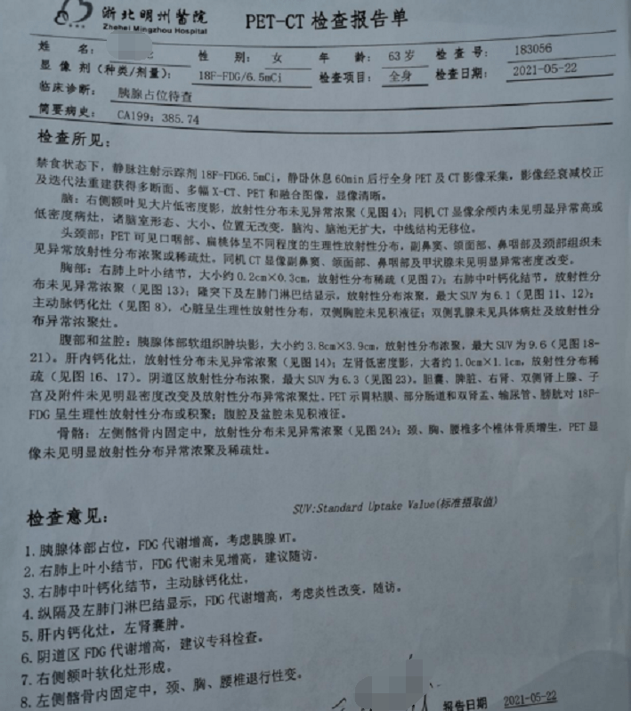 【病例解析】胰头沟突部癌晚期,做不了根治性切除手术怎么办?