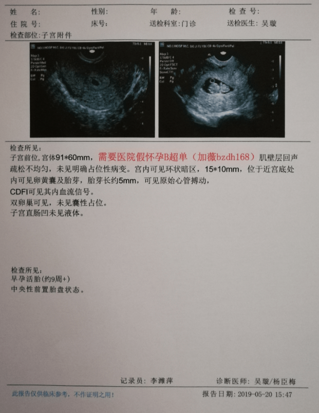 怀孕b超单图片