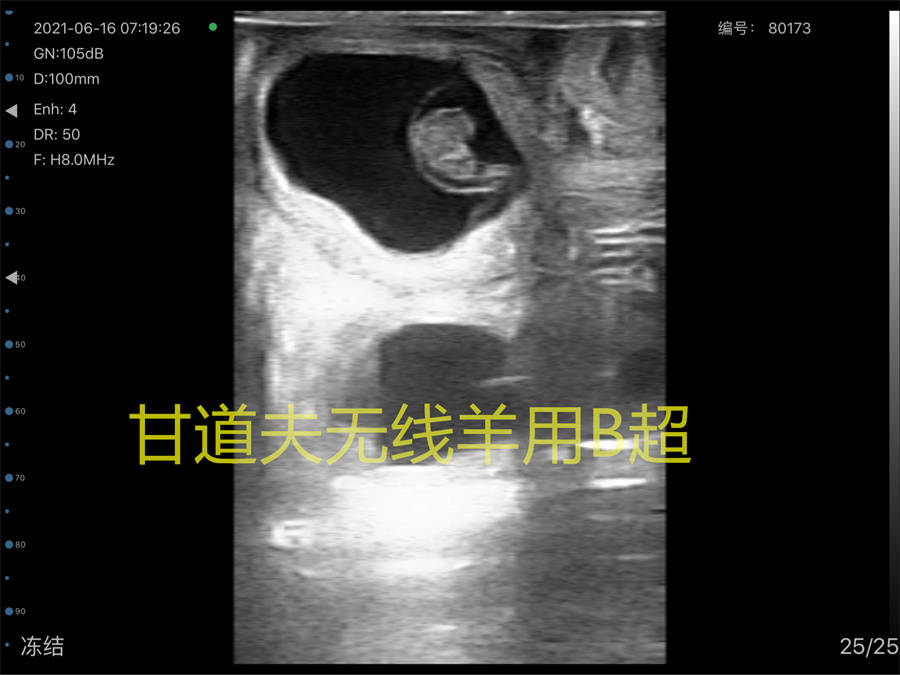 无线羊用b超使用方法检测母羊怀孕多胎图像判断_繁殖