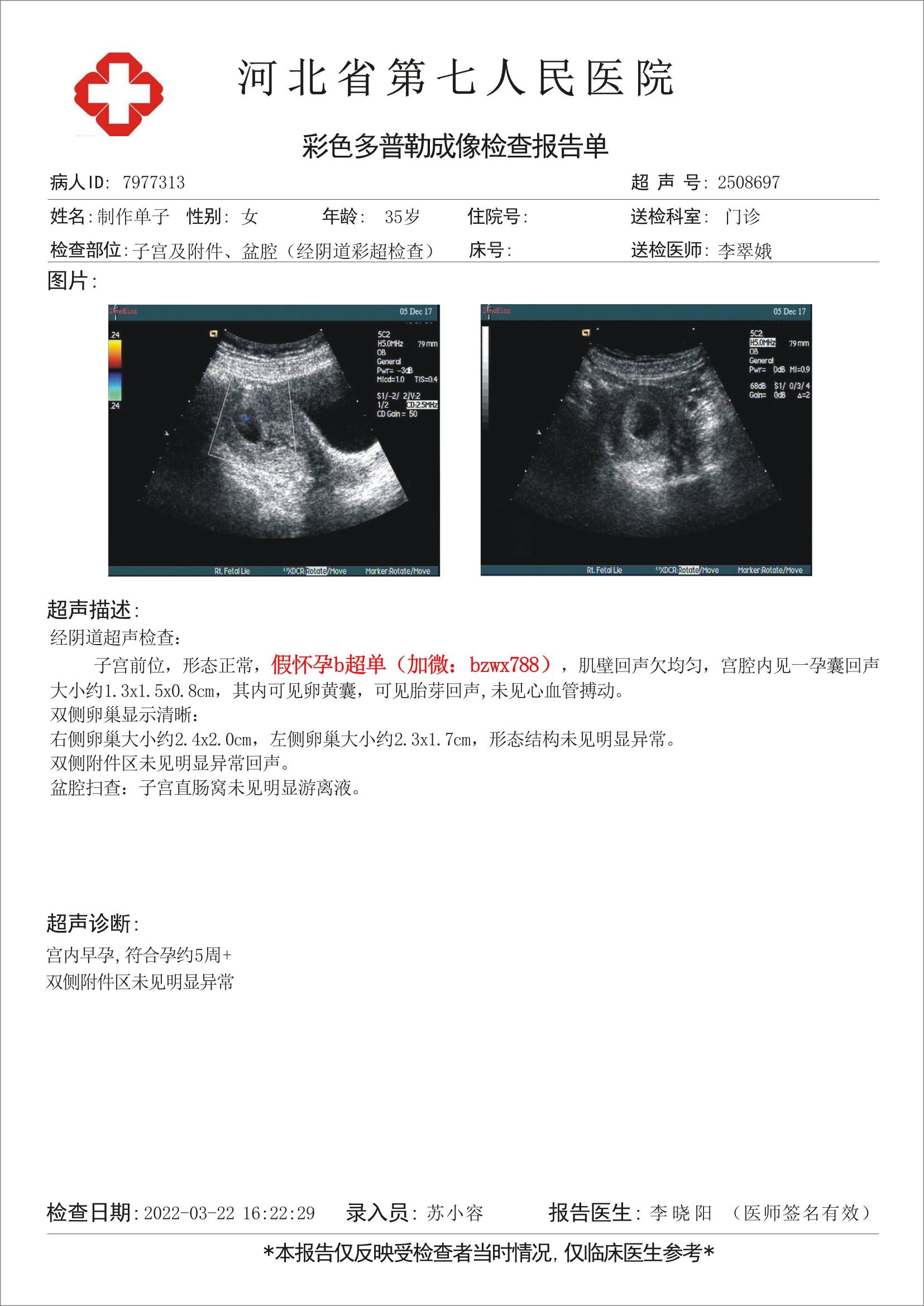 怀孕b超单在线制作,怀孕单子图片_生成器_报告单_软件