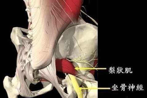 腿无力?是这块肌肉的问题没错了!_坐骨神经_臀部_骨盆