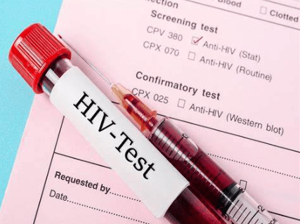 原标题：搜狐医药 | Nature：全球第三例HIV治愈病人得到确认