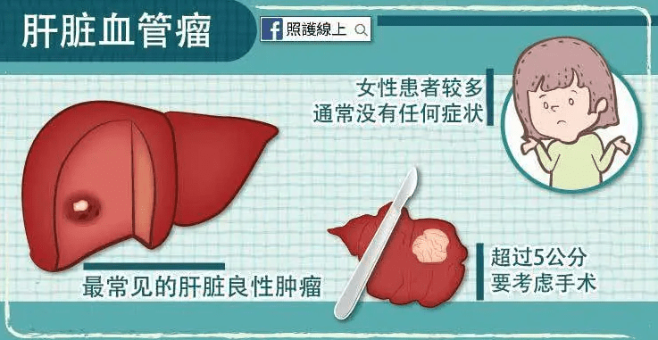 中医治疗肝血管瘤的选方用药思路，收藏不亏