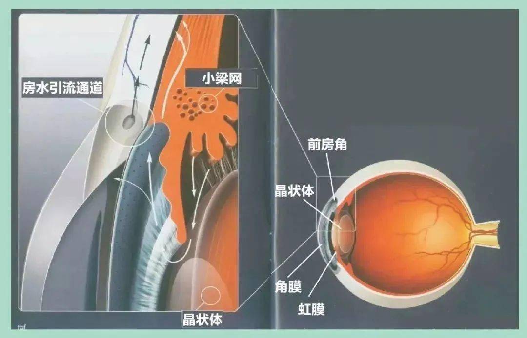 瞳孔自然放大,虹膜根部会增厚,使得房角狭窄或关闭,加剧房水循环障碍