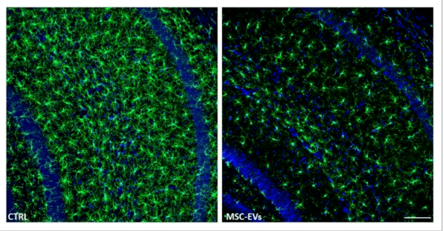 图像显示了iba-1 -小胶质细胞(绿色)在pbs-(ctrl)和ev处理(msc-evs)