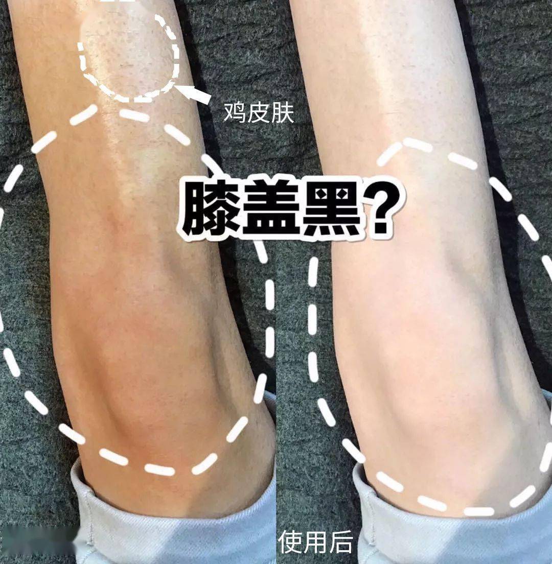 更白,显得更瘦更长哟~有了amnmts丝袜喷雾,不穿丝袜照样能盖住大黑腿