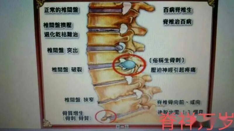 (2)下肢放射性疼痛:由于腰椎间盘突出多发生在腰4,5和腰5骶1椎间隙