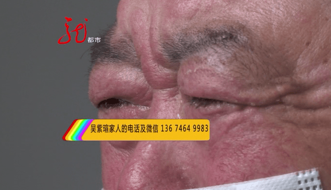 吴业江|自己双手也被严重烧伤，如今他说：我失去儿子，再不能失去我爱人了他救出来妻儿