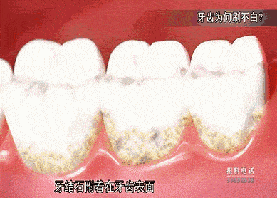7f3c96000a6e4e99b72501e61d765a7b.gif