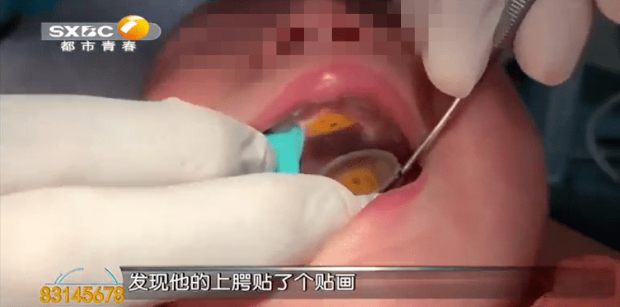女童|每家都有！危险！西安一岁女童嘴里藏了个东西差点窒息