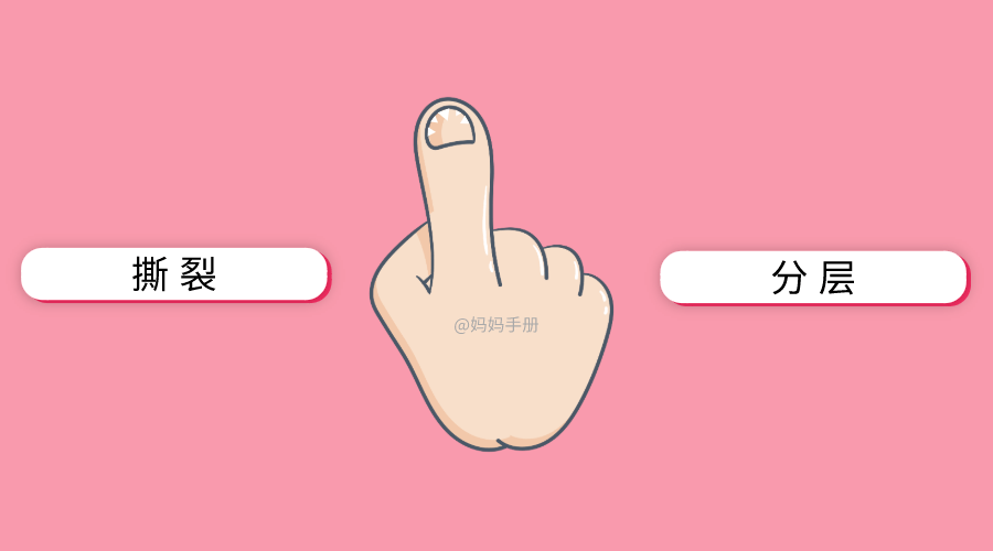 孩子|看指甲就知道！孩子身体好不好