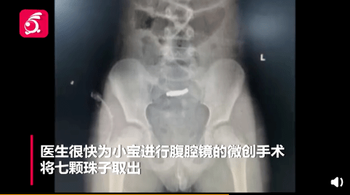 夺命儿童玩具，还不当回事？