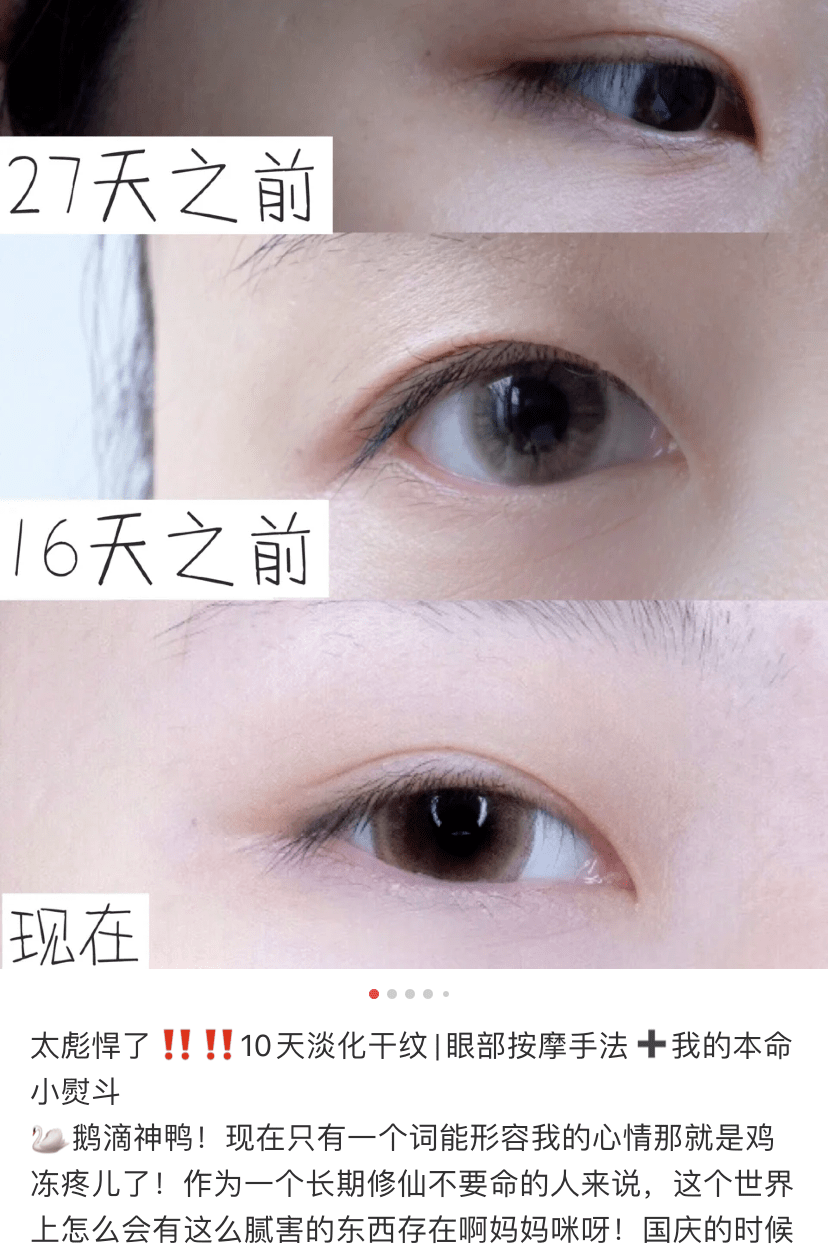 瑞典33位女性经3个月实测：变态眼霜把70岁奶奶的眼纹淡化了，还消水肿