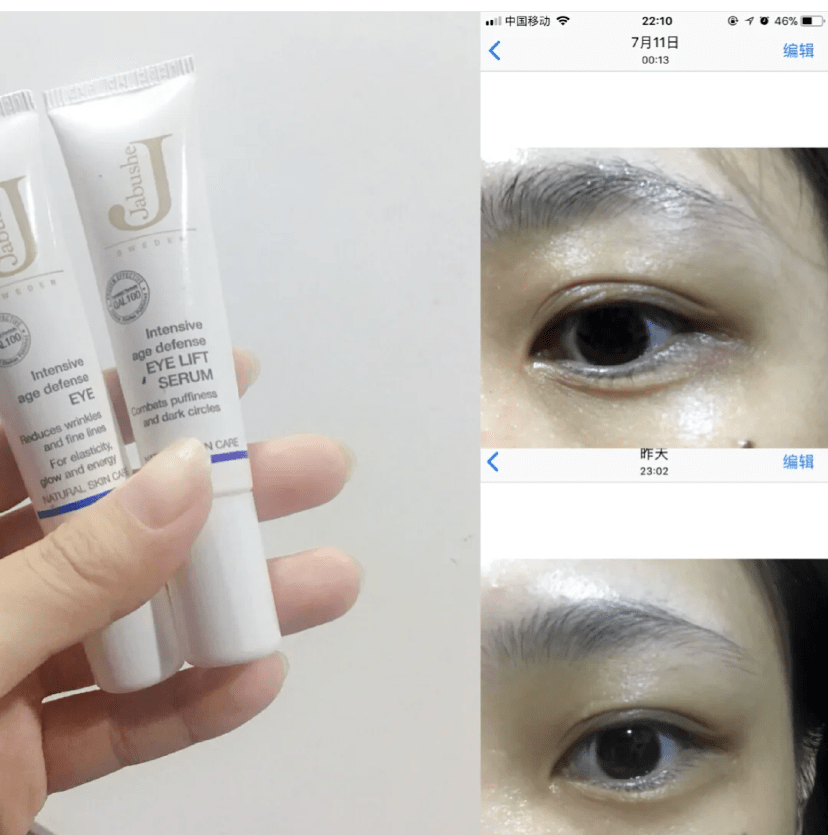 瑞典33位女性经3个月实测：变态眼霜把70岁奶奶的眼纹淡化了，还消水肿