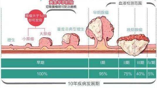 突发肠癌离世,家属称其曾肛周发痒,有关吗?医生辟谣跟