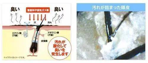 李佳琦推荐的脱发克星!一次就能拯救头屑头痒头油,用了它头发都会跳舞!