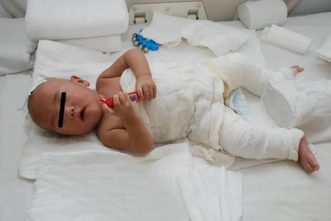 连医生|妈妈的急救方法，连医生都点赞男婴被100℃热水烫伤