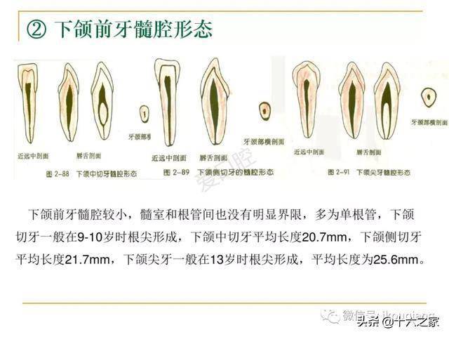 牙体髓腔解剖系统开髓开髓洞型及根管常用器械的认识和使用