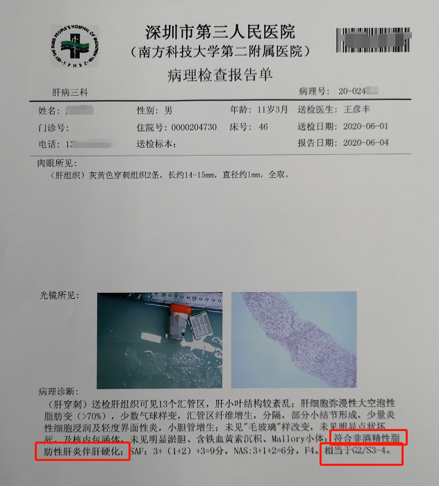 罪魁祸首|深圳11岁男童竟得了重度肝硬化~罪魁祸首是……家长们要注意了~