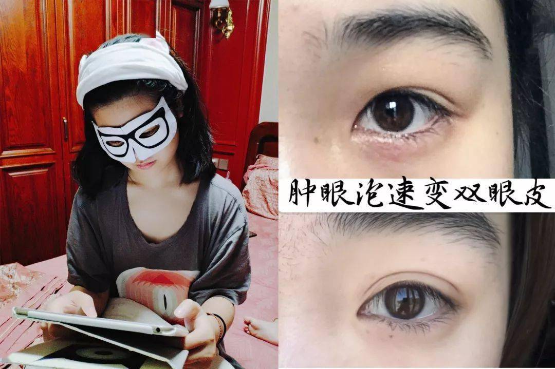 一片=10贴眼膜！解救“疲劳眼”！25分钟蒸走干黑眼圈，还你少女明眸