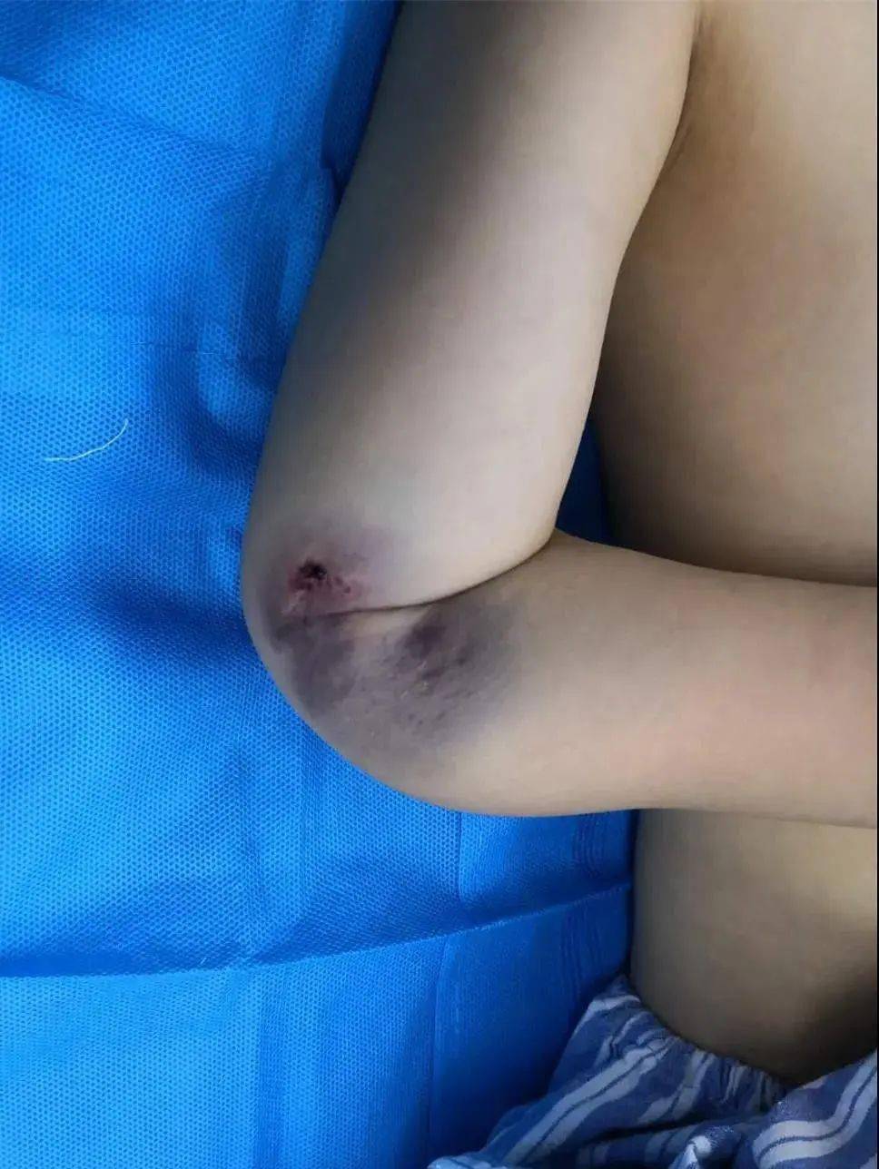 孩子|很多家庭都有!紧急提醒!淄博一医院连续接诊4名孩子!这个东西