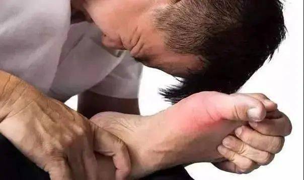 喝什么降尿酸降三高 aaee5563c3664a1399e6ada4a2232acb.jpeg