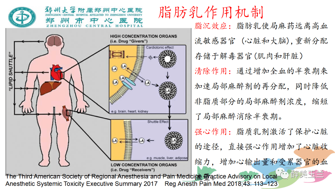 文献学习▏局麻药中毒的麻醉管理