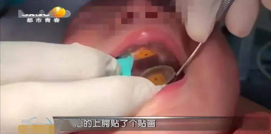 女童|孩子们都爱玩它,家长速查你家有没有!危险!一岁女童嘴里藏了个东西差点窒息