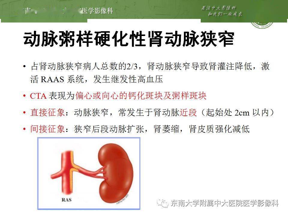 肾动脉发育异常及肾动脉相关疾病