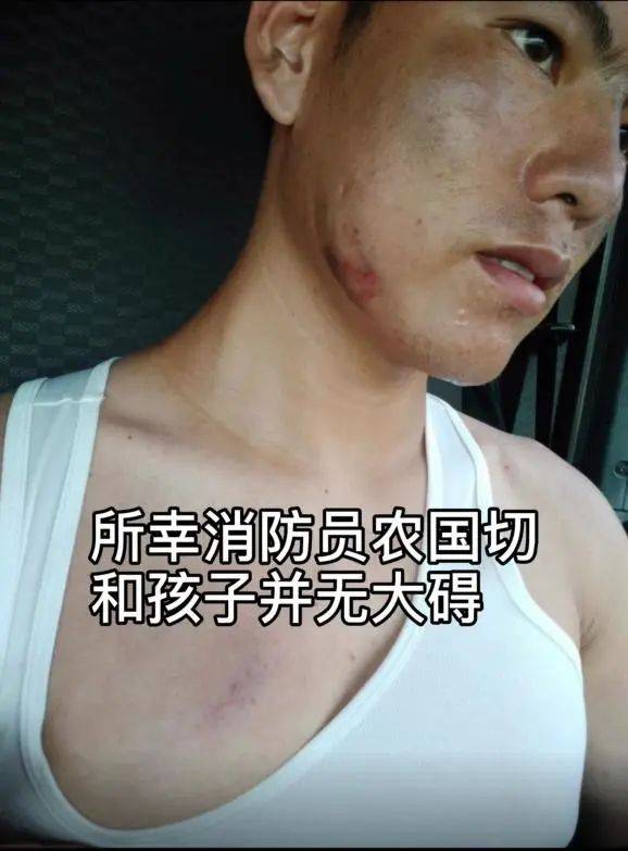 农国|6岁男童被父亲追杀，他竟用头挡刀救人……