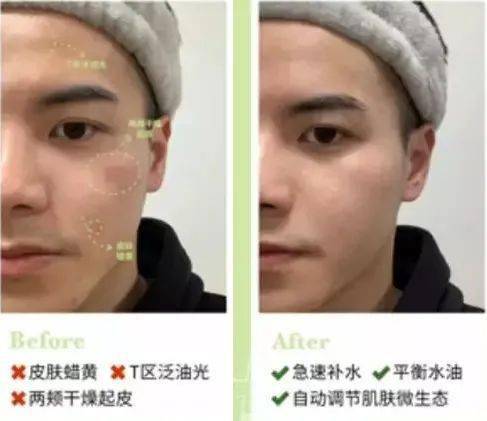 毛孔|原来想要拥有干净、清透的“初恋素颜脸”，只需要做好这一步！