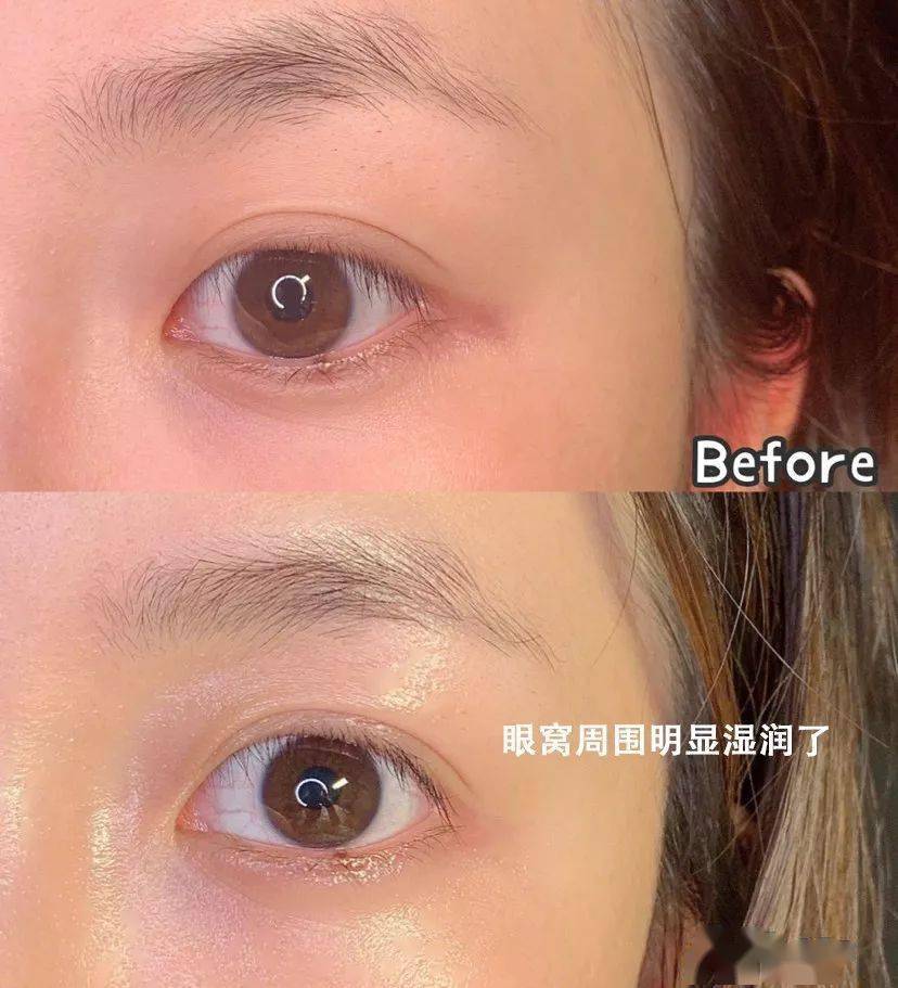 眼罩|明亮双眸!新一代冰感眼罩,冰热双温SPA,赶走黑眼圈、红血丝!