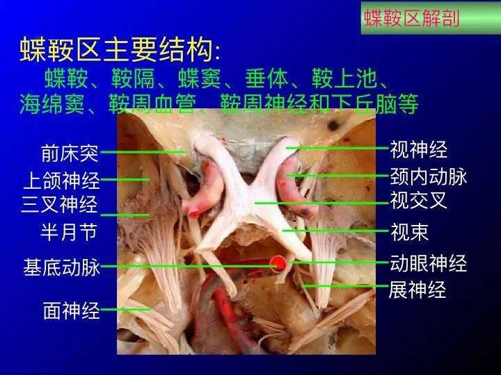 【推荐】鞍区应用解剖 断层解剖图谱