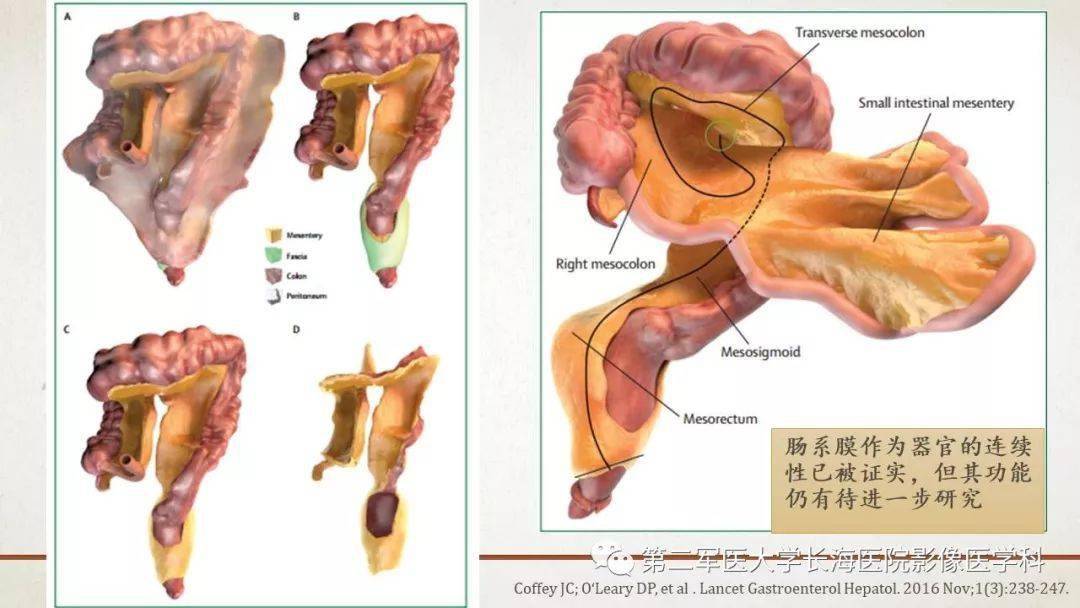 腹膜相关结构的影像解剖_肠系膜