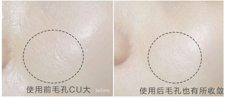 角质|能搓出“脏东西”的它3秒卖出一瓶！去角质、黑头、收毛孔，给你肌肤来次“大扫除”!