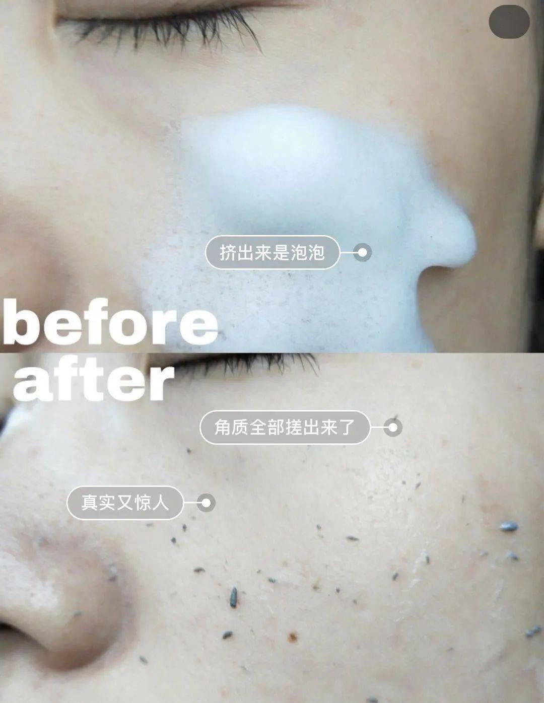角质|能搓出“脏东西”的它3秒卖出一瓶！去角质、黑头、收毛孔，给你肌肤来次“大扫除”!