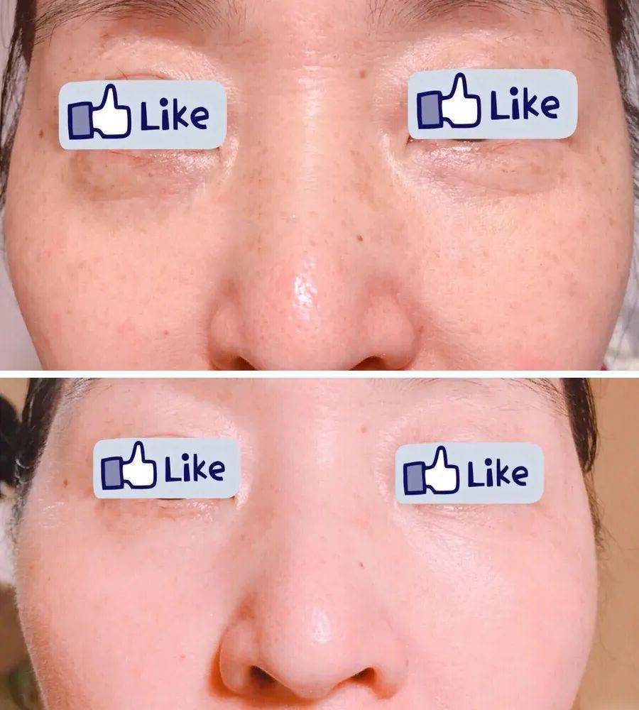 精华|千元大牌79元起！口碑水乳、眼霜精华，人气洁面应有尽有