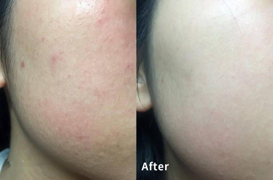 肌肤|40岁的逆袭 聪明的女人保鲜用这招