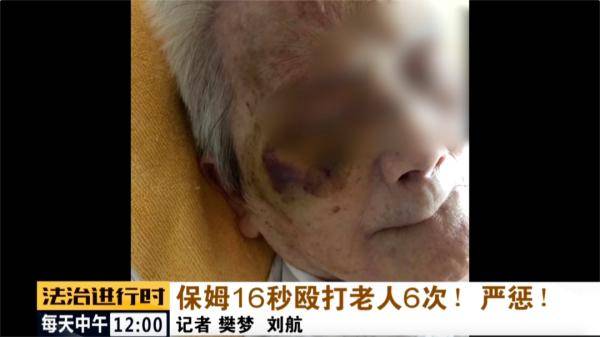 恒耀平台官网触目惊心!保姆16秒殴打85岁老人6次!严惩!(图7) 恒耀平台官网触目惊心!保姆16秒殴打85岁老人6次!严惩!(图7)