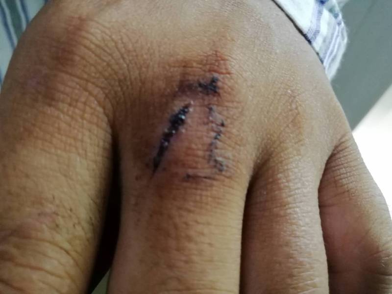 公司|惠州“快递哥”挺身救人身中两刀！听他讲述救人细节