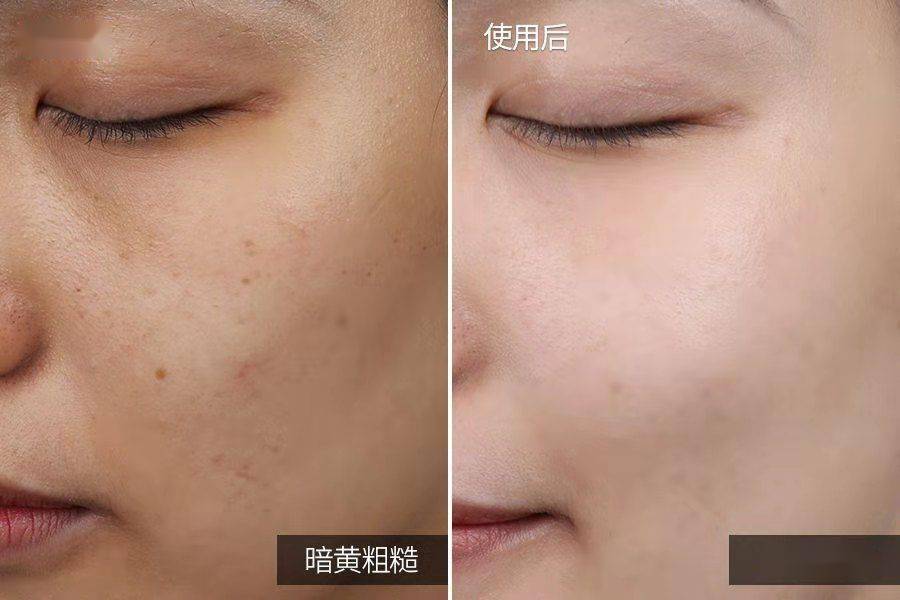 面膜|官宣？！《乘风破浪的姐姐》保养C位出圈的绝对是她...