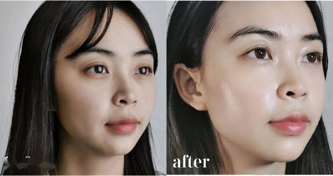 黑色素|薇娅直播间1分钟卖出10000瓶的美白精华，真的好用吗？