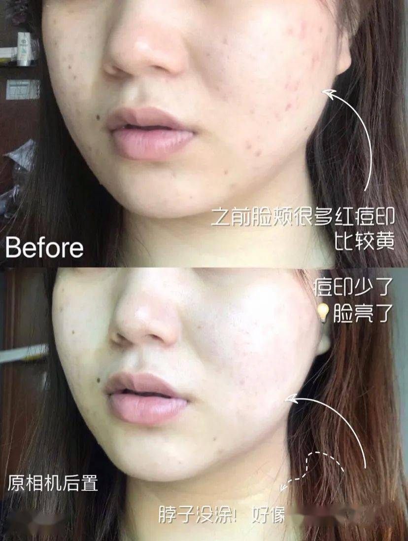 黑头|沈梦辰没骗我！HFP这些宝藏单品，真的让我“一夜换脸”！